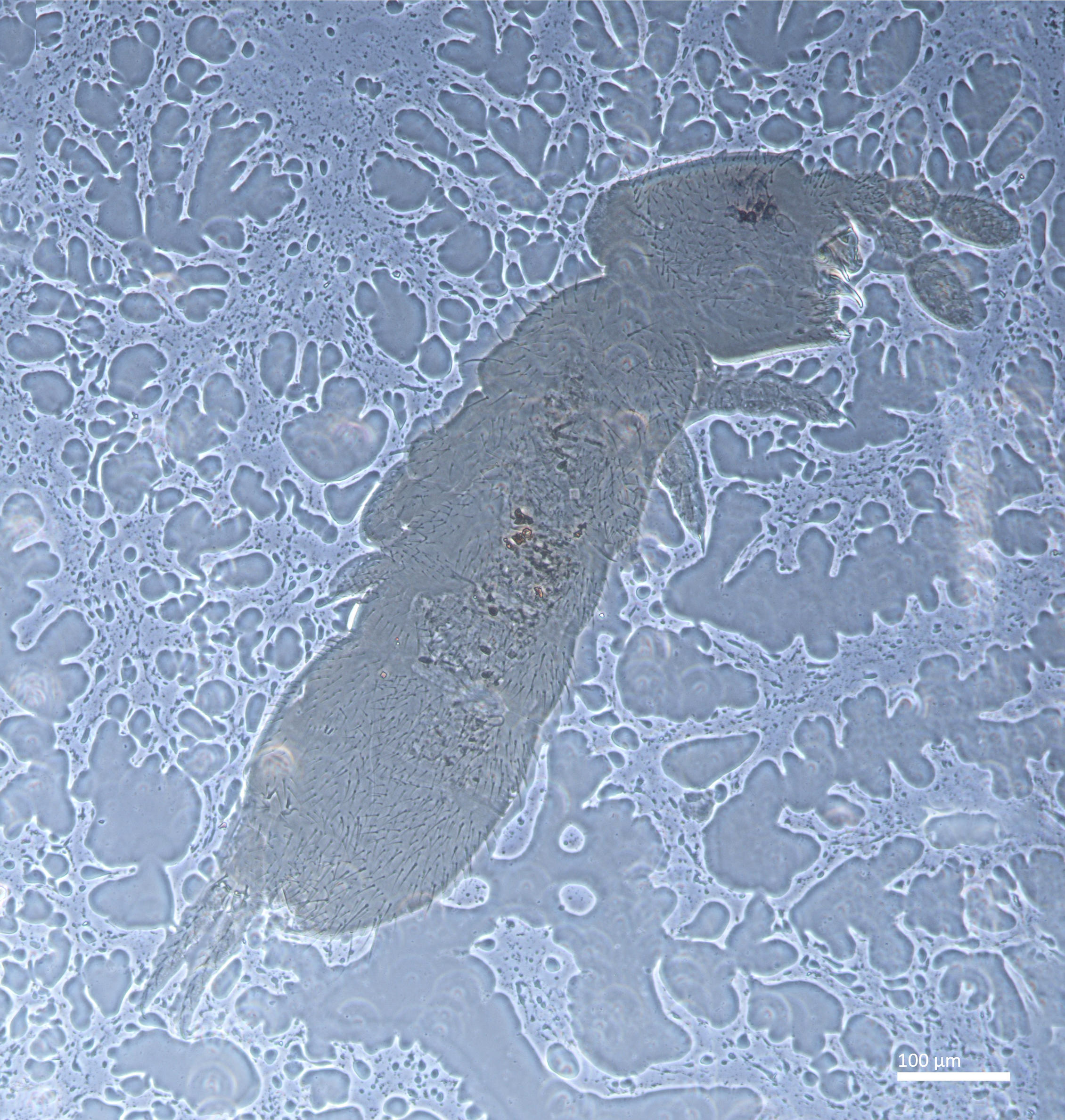 Slide preparation of Hemisotoma thermophila, housed in the ICCDRS collection (ICCDRS 26852). Photo: Marc Barreda, CDF, 2024.